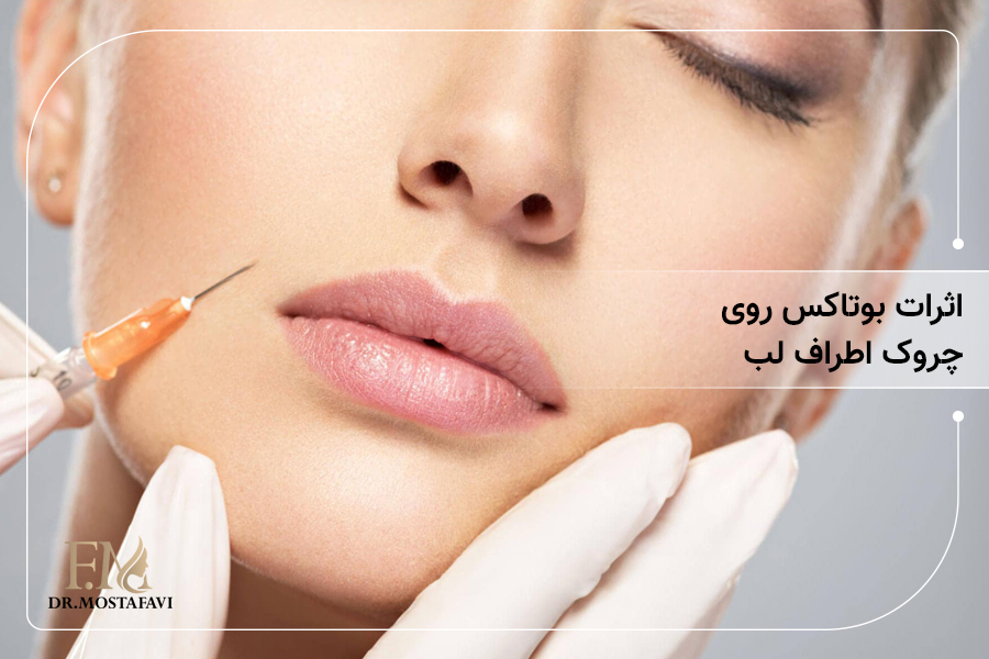 اثر بوتاکس روی چروک اطراف لب