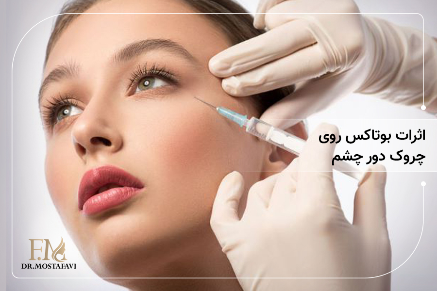اثر بوتاکس روی چروک دور چشم