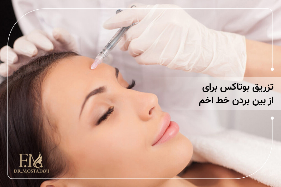 تزریق بوتاکس برای از بین بردن خط اخم