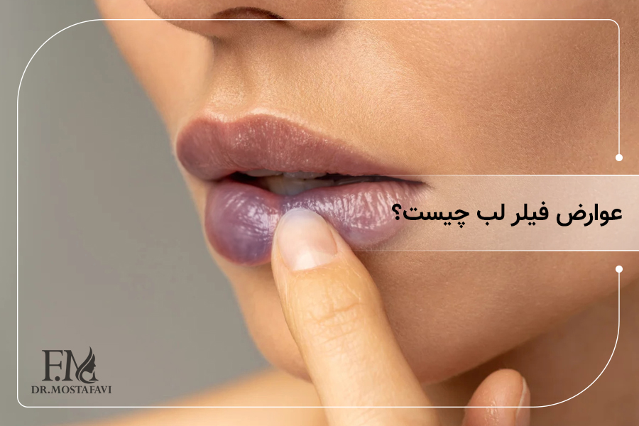 عوارض فیلر لب چیست؟