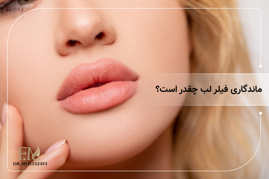 ماندگاری فیلر لب چقدر است؟