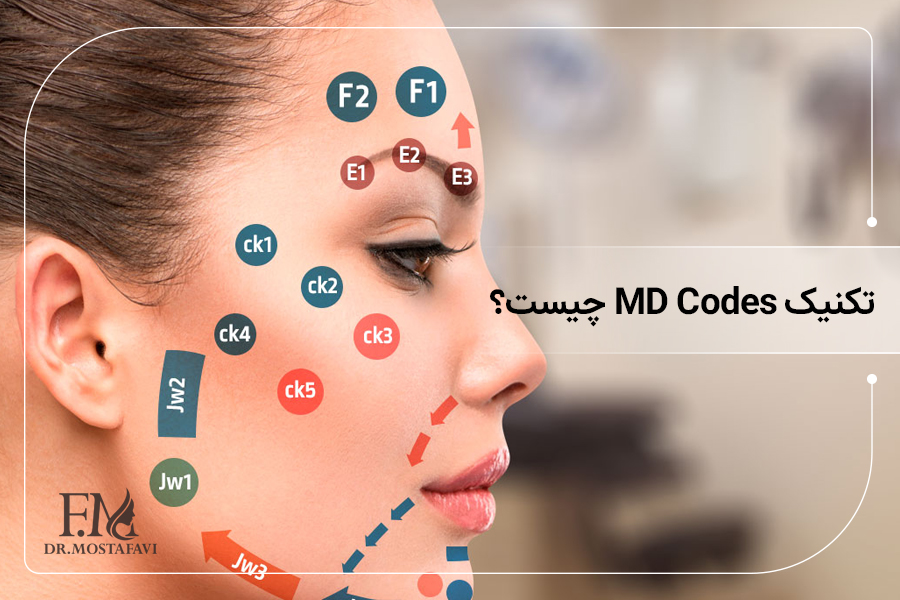 تکنیک MD Codes چیست؟