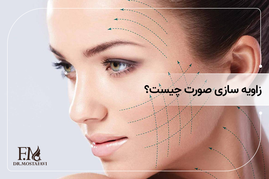 زاویه سازی صورت چیست؟