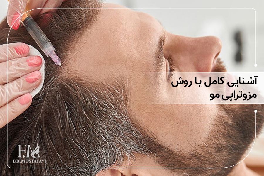 آشنایی کامل با روش مزوتراپی مو