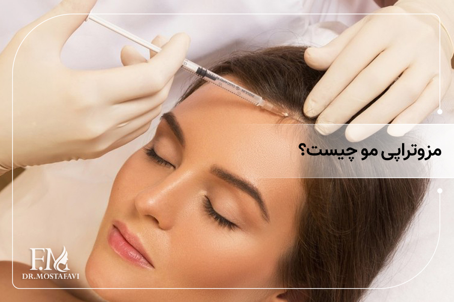 مزوتراپی مو چیست؟