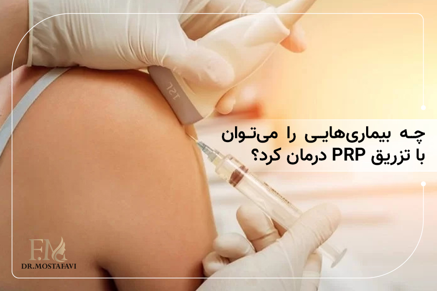 چه بیماریهایی را میتوان با تزریق PRP درمان کرد؟