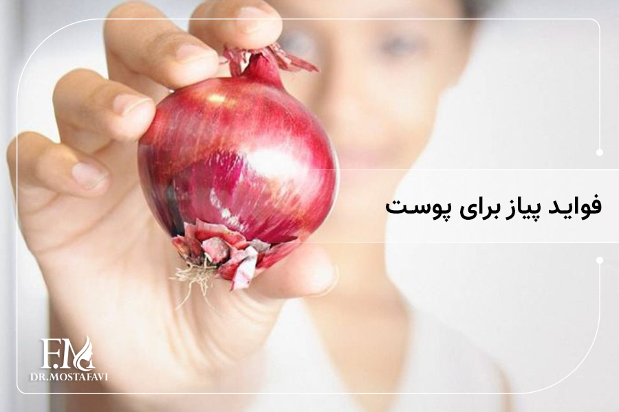 فواید پیاز برای پوست
